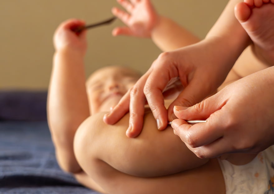 体質改善はりきゅう