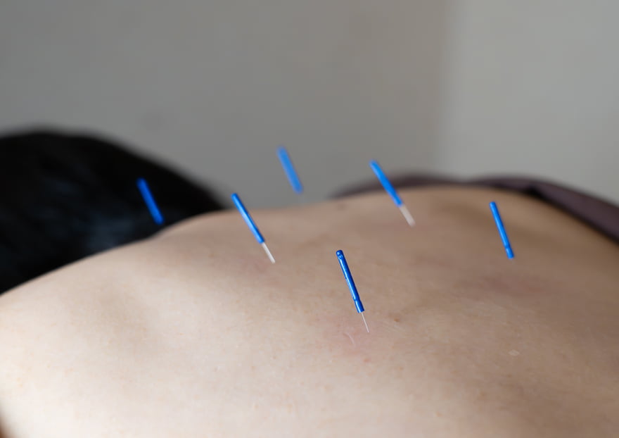 はりきゅう・マッサージ＜Noll(ノル)＞｜体質改善はりきゅう