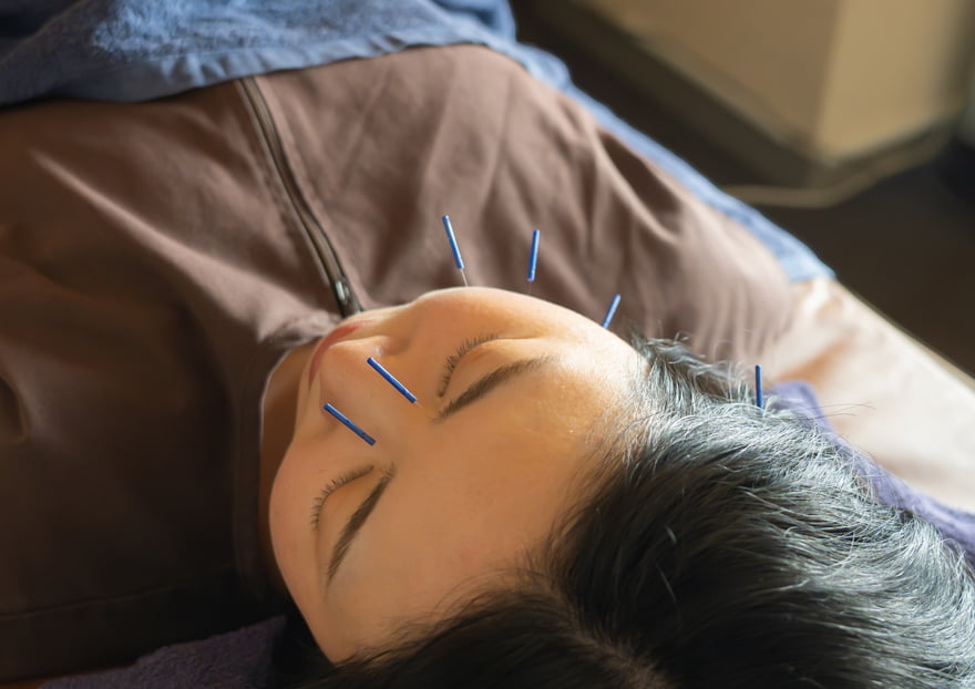 はりきゅう・マッサージ＜Noll(ノル)＞｜すずめ美容鍼