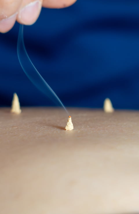 Noll＜ノル＞｜札幌マタニティはりきゅう・マッサージ・美容鍼・札幌訪問鍼灸｜中央区・桑園・鍼灸